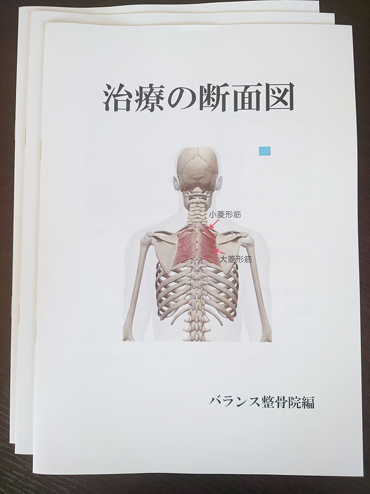 治療の断面図